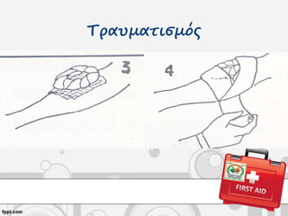 Τραυματισμός
 