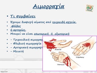 Αιμορραγία
• Τι συμβαίνει
• Έχουμε διαφυγή αίματος από τριχοειδή αγγεία,
• φλέβες
• ή αρτηρίες,
• Μπορεί να είναι εσωτερική ή εξωτερική
• - Τριχοειδική αιμορραγία
• - Φλεβική αιμορραγία
• - Αρτηριακή αιμορραγία
• - Μεικτή
 