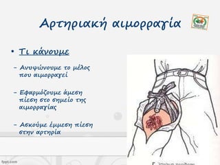 Αρτηριακή αιμορραγία
• Τι κάνουμε
- Ανυψώνουμε το μέλος
που αιμορραγεί
- Εφαρμόζουμε άμεση
πίεση στο σημείο της
αιμορραγίας
- Ασκούμε έμμεση πίεση
στην αρτηρία
 