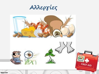 Αλλεργίες
 