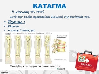 Η κάκωση του οστού
κατά την οποία προκαλείται διακοπή της συνέχειάς του.
• Έχουμε :
• Κλειστό
• ή ανοιχτό κάταγμα
ΚΑΤΑΓΜΑ
 