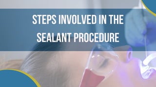 Steps Involved in the
Sealant Procedure
 