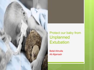 Protect our baby from
Unplanned
Extubation
Belal Almulla
Ali Aljarrash
 