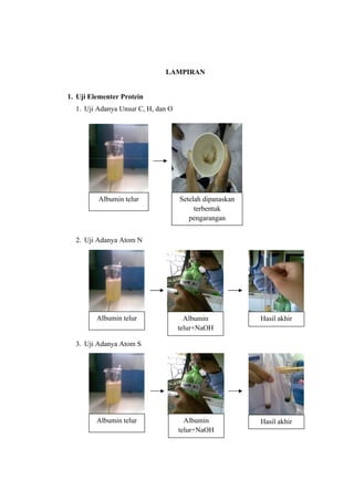 LAMPIRAN


1. Uji Elementer Protein
  1. Uji Adanya Unsur C, H, dan O




         Albumin telur              Setelah dipanaskan
                                         terbentuk
                                       pengarangan


  2. Uji Adanya Atom N




         Albumin telur                Albumin            Hasil akhir
                                    telur+NaOH

  3. Uji Adanya Atom S




         Albumin telur                Albumin            Hasil akhir
                                    telur+NaOH
 