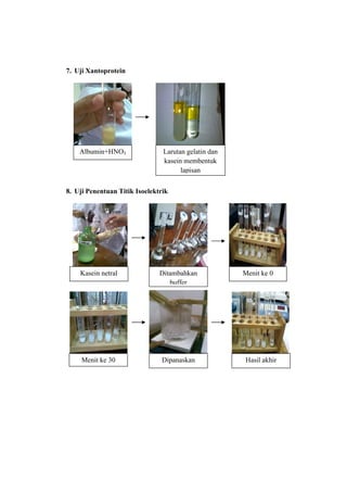 7. Uji Xantoprotein




    Albumin+HNO3                Larutan gelatin dan
                                kasein membentuk
                                      lapisan

8. Uji Penentuan Titik Isoelektrik




    Kasein netral              Ditambahkan            Menit ke 0
                                  buffer




     Menit ke 30                Dipanaskan            Hasil akhir
 