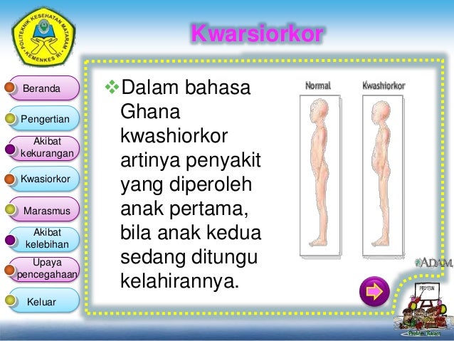 Akibat Kekurangan dan Kelebihan Protein