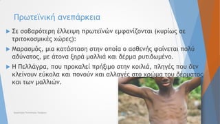  Σε σοβαρότερη έλλειψη πρωτεϊνών εμφανίζονται (κυρίως σε
τριτοκοσμικές χώρες):
 Μαρασμός, μια κατάσταση στην οποία ο ασθενής φαίνεται πολύ
αδύνατος, με άτονα ξηρά μαλλιά και δέρμα ρυτιδωμένο.
 Η Πελλάγρα, που προκαλεί πρήξιμο στην κοιλιά, πληγές που δεν
κλείνουν εύκολα και πονούν και αλλαγές στο χρώμα του δέρματος
και των μαλλιών.
Πρωτεϊνική ανεπάρκεια
Εργαστήριο Τεχνολογίας Τροφίμων
 