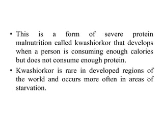 • This is a form of severe protein
malnutrition called kwashiorkor that develops
when a person is consuming enough calories
but does not consume enough protein.
• Kwashiorkor is rare in developed regions of
the world and occurs more often in areas of
starvation.
 