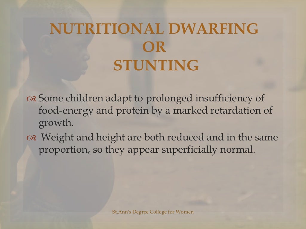Protein Energy Malnutrition