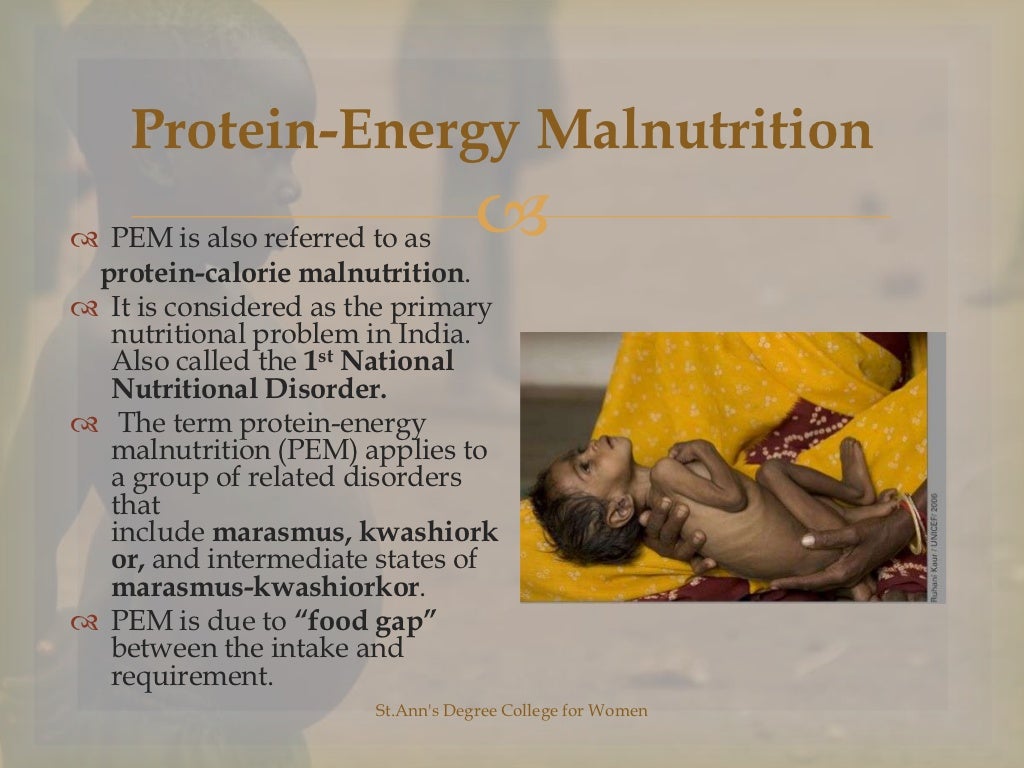 protein-energy-malnutrition