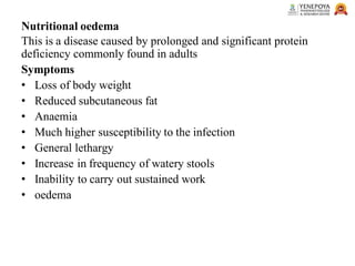 Nutritional oedema
This is a disease caused by prolonged and significant protein
deficiency commonly found in adults
Symptoms
• Loss of body weight
• Reduced subcutaneous fat
• Anaemia
• Much higher susceptibility to the infection
• General lethargy
• Increase in frequency of watery stools
• Inability to carry out sustained work
• oedema
 