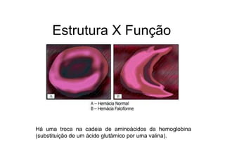 Estrutura X Função
Há uma troca na cadeia de aminoácidos da hemoglobina
(substituição de um ácido glutâmico por uma valina).
 