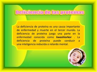 La deficiencia de proteína es una causa importante
de enfermedad y muerte en el tercer mundo. La
deficiencia de proteína juega una parte en la
enfermedad conocida como kwashiorkor . La
deficiencia de proteína puede conducir a
una inteligencia reducida o retardo mental.

 