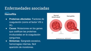 Enfermedades asociadas
Hemofilia
● Proteínas afectadas: Factores de
coagulación (como el factor VIII o
IX).
● Causa: Mutaciones en los genes
que codifican las proteínas
involucradas en la coagulación
sanguínea.
● Síntomas: Sangrado excesivo,
hemorragias internas, fácil
aparición de moretones.
 