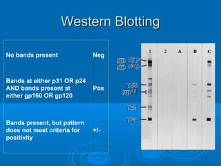 No bands present Neg
Bands at either p31 OR p24
AND bands present at
either gp160 OR gp120
Pos
Bands present, but pattern
does not meet criteria for
positivity
+/-
Western BlottingWestern Blotting
 