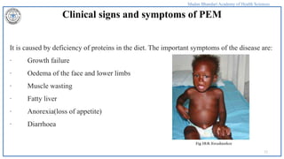 Comprehensive Prevention and Management of Protein-Energy Malnutrition ...