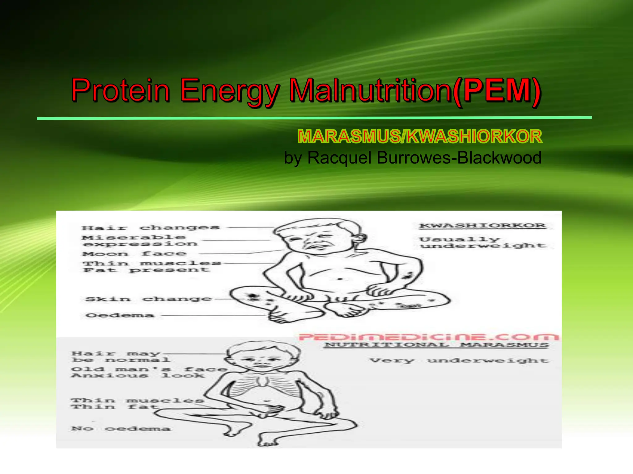 PROTEIN ENERGY MALNUTRITION(1)-2.pptx