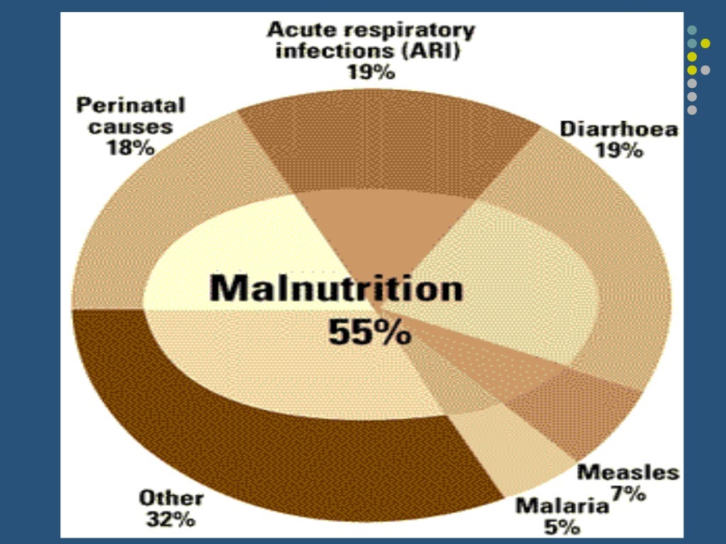 Protein energy malnutrition among children