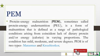 Protein energy malnutrition in children english | PPTX