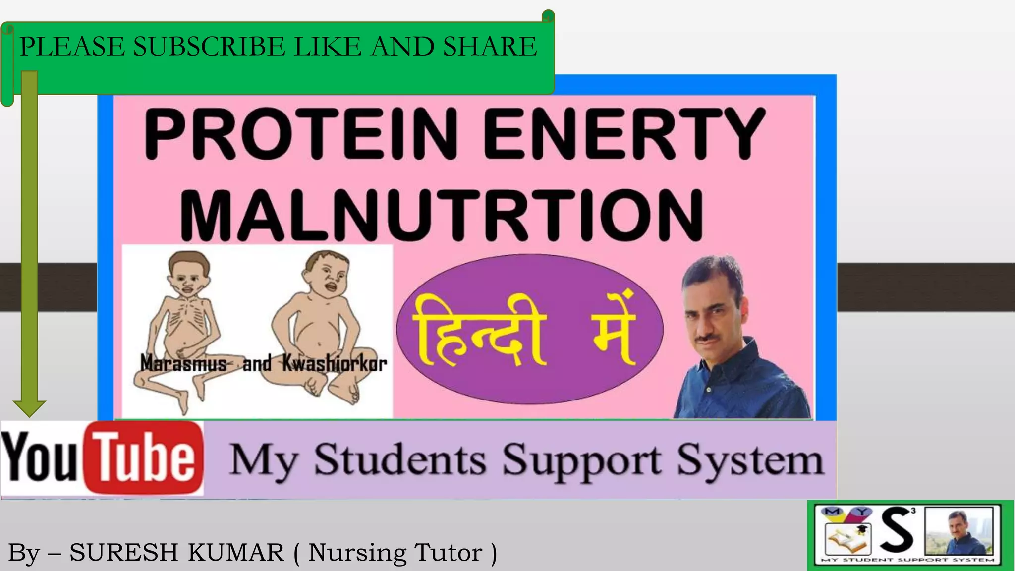 Protein energy malnutrition in children hindi PPT