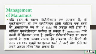 Protein energy malnutrition in children hindi | PPTX