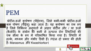 Protein energy malnutrition in children hindi | PPTX