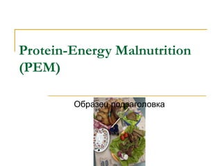 Protein-Energy Malnutrition
(PEM)
Образец подзаголовка
 