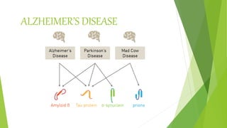 ALZHEIMER’S DISEASE
 