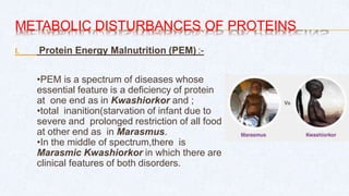 METABOLIC DISTURBANCES OF PROTEINS
I. Protein Energy Malnutrition (PEM) :-
•PEM is a spectrum of diseases whose
essential feature is a deficiency of protein
at one end as in Kwashiorkor and ;
•total inanition(starvation of infant due to
severe and prolonged restriction of all food
at other end as in Marasmus.
•In the middle of spectrum,there is
Marasmic Kwashiorkor in which there are
clinical features of both disorders.
 