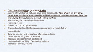  Oral manifestations of Kwashiorkor
 Mouths of Kwashiorkor patients have been described by Van Wyk to be dry, dirty,
caries free, easily traumatized with epithelium readily become detached from the
underlying tissue, leaving a raw, beeding surface
 Bilateral angular cheilosis (inflammation)
 Fissuring of lips
 Loss of circumoral pigmentation
 Crowded and rotated teeth giving an appearance of mouth full of
jumbled teeth
 Delayed eruption and hypoplasia of deciduous teeth
 Incisor and molar growth is retarded
 Radicular osteocementum decreased
 Increased acid solubility of enamel of incisors
 Decreased salivary volume
 