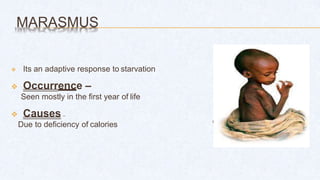 MARASMUS
d
 Its an adaptive response to starvation
 Occurrence –
Seen mostly in the first year of life
 Causes –
Due to deficiency of calories
 