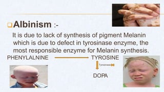 Albinism :-
It is due to lack of synthesis of pigment Melanin
which is due to defect in tyrosinase enzyme, the
most responsible enzyme for Melanin synthesis.
PHENYLALNINE TYROSINE
Tyrosinase
DOPA
 