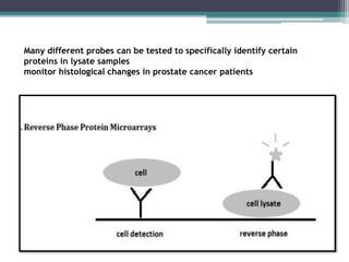 Many different probes can be tested to specifically identify certain
proteins in lysate samples
monitor histological changes in prostate cancer patients
 