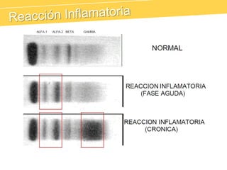 Alfa-1 Lipoproteína (HDL)