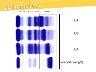 Alfa-2 Macroglobulina