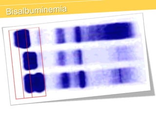 Fracción Beta-1 y 2RFAFibrinógeno