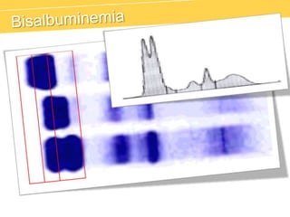 Beta-2 Microglobulina
