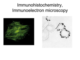 Immunohistochemistry, Immunoelectron microscopy 