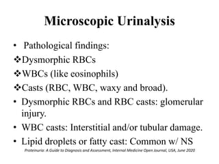 Microscopic Urinalysis
• Pathological findings:
Dysmorphic RBCs
WBCs (like eosinophils)
Casts (RBC, WBC, waxy and broad).
• Dysmorphic RBCs and RBC casts: glomerular
injury.
• WBC casts: Interstitial and/or tubular damage.
• Lipid droplets or fatty cast: Common w/ NS
Proteinuria: A Guide to Diagnosis and Assessment, Internal Medicine Open Journal, USA, June 2020
 