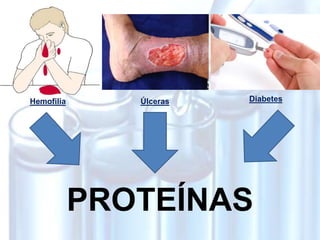Hemofilia Úlceras Diabetes
PROTEÍNAS
 