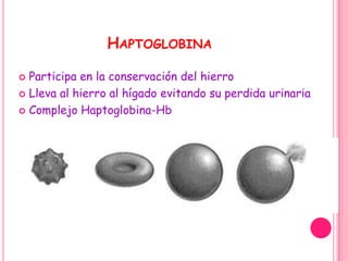 HAPTOGLOBINA

 Participa en la conservación del hierro
 Lleva al hierro al hígado evitando su perdida urinaria

 Complejo Haptoglobina-Hb
 