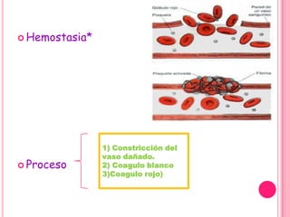  Hemostasia*




                1) Constricción del
                vaso dañado.
 Proceso       2) Coagulo blanco
                3)Coagulo rojo)
 