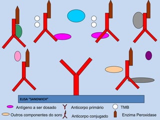 Outros componentes do soro
ELISA “SANDWICH”
Antígeno a ser dosado Anticorpo primário
Anticorpo conjugado
TMB
Enzima Peroxidase
 