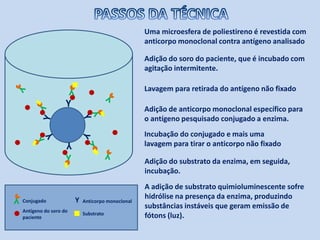 Adição de anticorpo monoclonal específico para
o antígeno pesquisado conjugado a enzima.
Uma microesfera de poliestireno é revestida com
anticorpo monoclonal contra antígeno analisado
Adição do soro do paciente, que é incubado com
agitação intermitente.
Lavagem para retirada do antígeno não fixado
Incubação do conjugado e mais uma
lavagem para tirar o anticorpo não fixadoY
Y
Y
Y
Adição do substrato da enzima, em seguida,
incubação.
A adição de substrato quimioluminescente sofre
hidrólise na presença da enzima, produzindo
substâncias instáveis que geram emissão de
fótons (luz).
Y
Y
Anticorpo monoclonal
Substrato
Conjugado
Antígeno do soro do
paciente
 