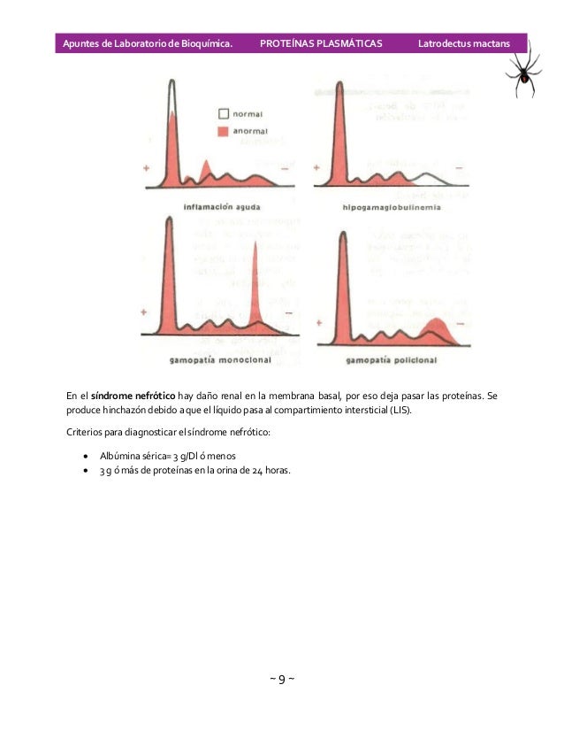 Proteínas plasmáticas. electroforesis de proteínas séricas