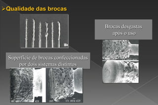 Superfície de brocas confeccionadas
por dois sistemas distintos
Brocas desgastas
após o uso
Qualidade das brocas
 