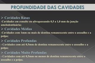  Cavidades Rasas
-Cavidades em esmalte ou ultrapassando 0,5 a 1,0 mm da junção
amelodentinária;
 Cavidades Médias
-Cavidades com 1mm ou mais de dentina remanescente entre o assoalho e a
polpa;
 Cavidades Profundas
- Cavidades com até 0,5mm de dentina remanescente entre o assoalho e a
polpa;
 Cavidades Muito Profundas
- Cavidades com até 0,5mm ou menos de dentina remanescente entre o
assoalho e a polpa.
PROFUNDIDADE DAS CAVIDADES
 