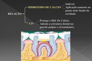 HIDRÓXIDO DE CÁLCIO
RELAÇÃO
CIV
Solúvel;
Aplicação somente no
ponto mais fundo da
cavidade.
Protege o Hid. De Cálcio;
Adesão a estrutura dental na
parede pulpar e circundantes.
 
