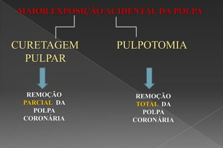 PULPOTOMIACURETAGEM
PULPAR
MAIOR EXPOSIÇÃO ACIDENTAL DA POLPA
REMOÇÃO
PARCIAL DA
POLPA
CORONÁRIA
REMOÇÃO
TOTAL DA
POLPA
CORONÁRIA
 