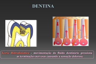 Teoria Hidrodinâmica - movimentação do fluido dentinário pressiona
as terminações nervosas causando a sensação dolorosa.
DENTINA
 
